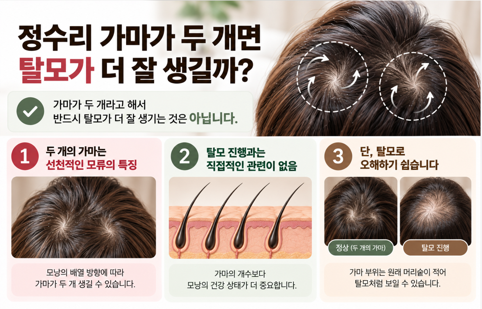 정수리 가마가 두 개라면 탈모 위험이 높을까요 1 image 48